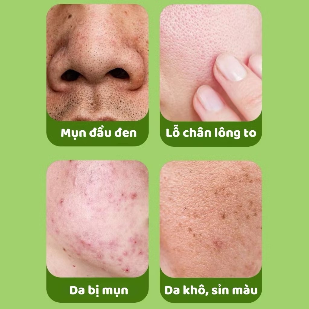 TẨY TẾ BÀO CHẾT DA BODY GINBi (2) '