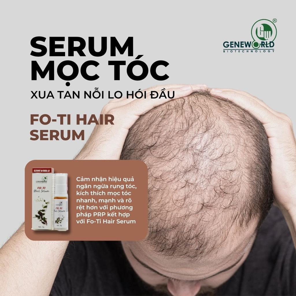 Sử dụng sản phẩm kích thích mọc tóc