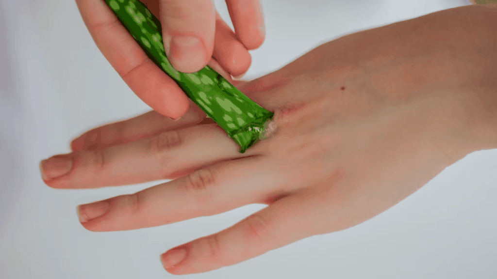 Gel lô hội chữa lành vết bỏng