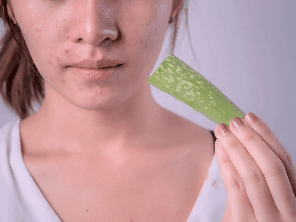Lô hội giúp điều trị mụn trứng cá