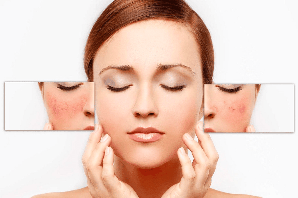 Da bị kích ứng là gì?