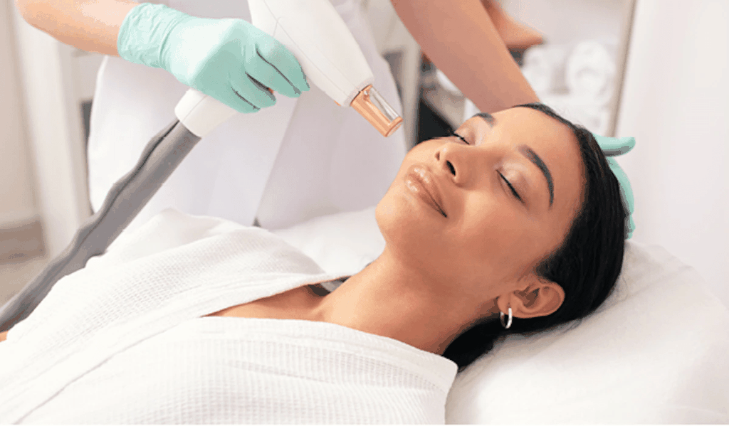 liệu pháp laser là cách làm giảm sắc tố melanin