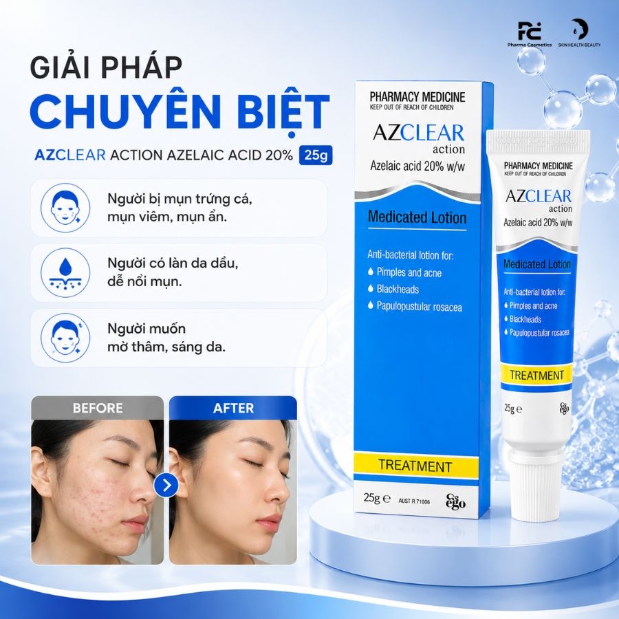 AZCLEAR ACTION AZELAIC ACID 20% 25g / KEM DƯỠNG GIẢM MỤN, MỜ THÂM