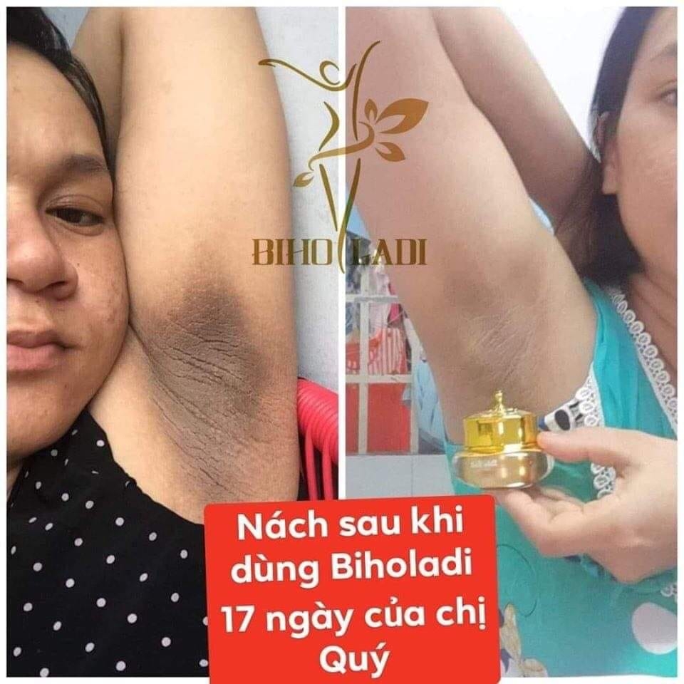 Biho Ladi 5S Siêu dưỡng thâm - Đặc trị thâm hôi