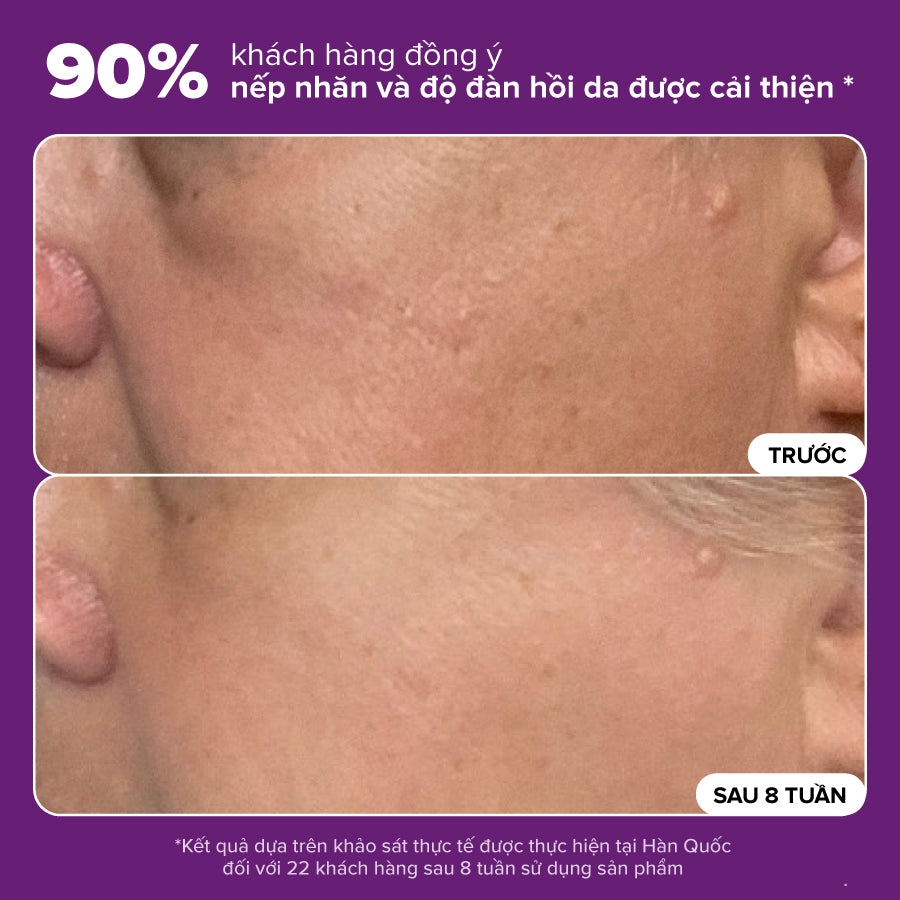 Nước cân bằng độ ẩm và thu nhỏ lỗ chân lông Skin Balancing Pore-Reducing Toner