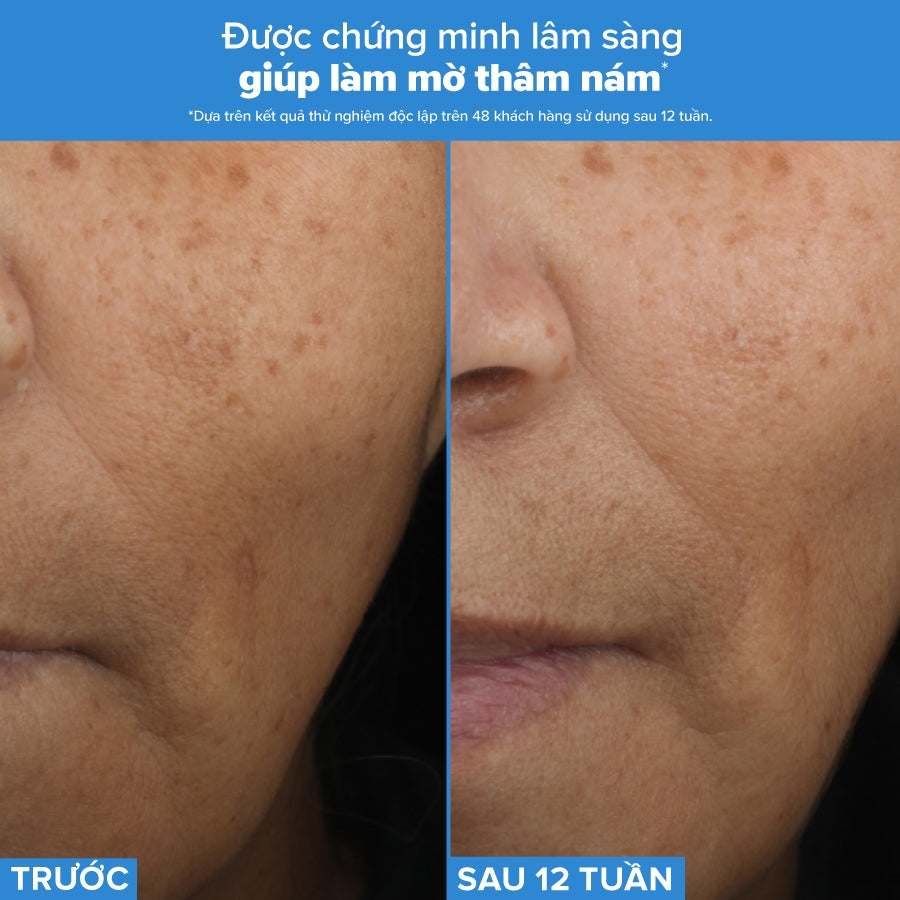 Tinh chất 3 tác động chống lão hóa, mờ thâm nám, giảm nếp nhăn và săn chắc da Resist Triple Active Total Repair Serum 30ml