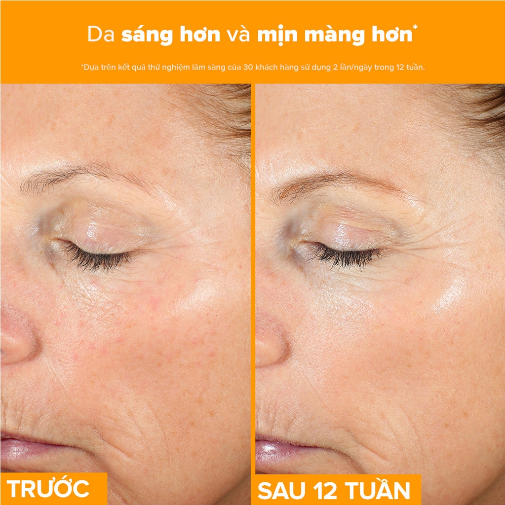 Tinh chất làm sáng da, mờ thâm nám và giảm nếp nhăn chứa 15% Vitamin C C15 Super Booster 20ml