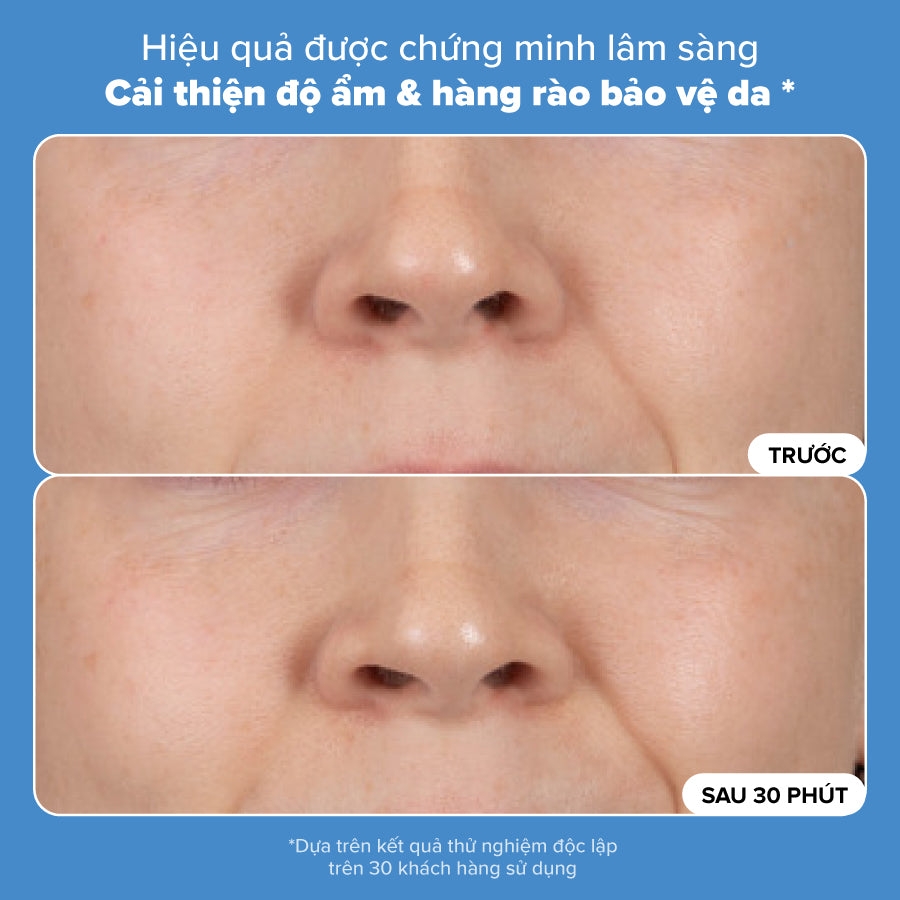 Kem dưỡng ẩm tái tạo hàng rào bảo vệ da, giảm nếp nhăn và làm săn chắc da Resist Barrier Repair Advanced Moisturizer 50ml