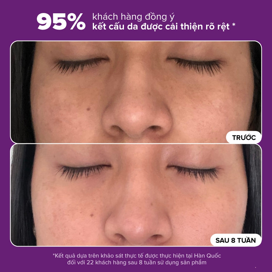 Nước cân bằng độ ẩm và thu nhỏ lỗ chân lông Skin Balancing Pore-Reducing Toner
