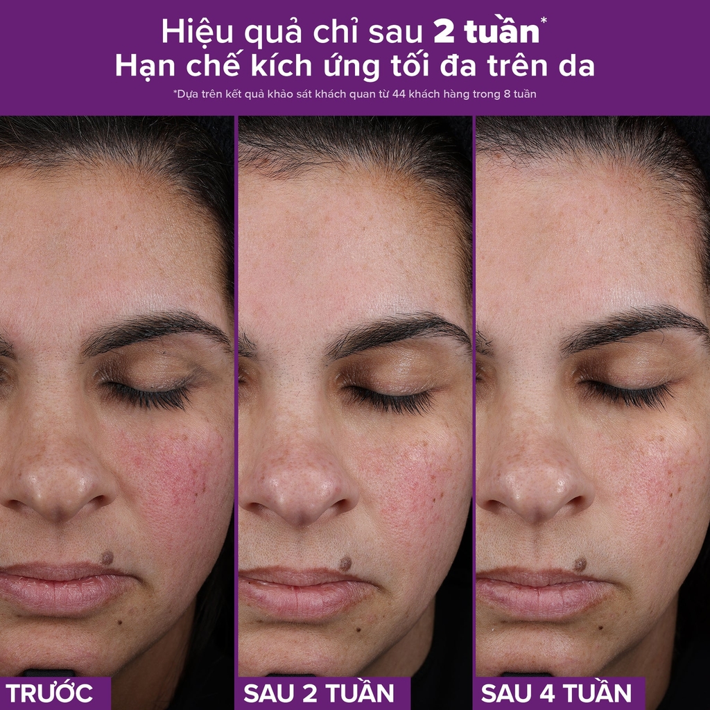 Tinh chất Retinaldehyde ngăn ngừa các dấu hiệu lão hóa và hỗ trợ giảm mụn PRO Retinaldehyde Treatment 30ml
