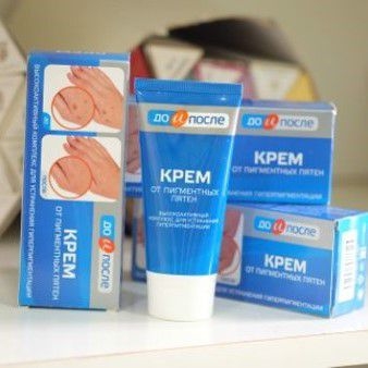 Kem Tay KPEM Trị Đồi Mồi, Vết Nám, Sạm, Đốm Nâu Da Tay