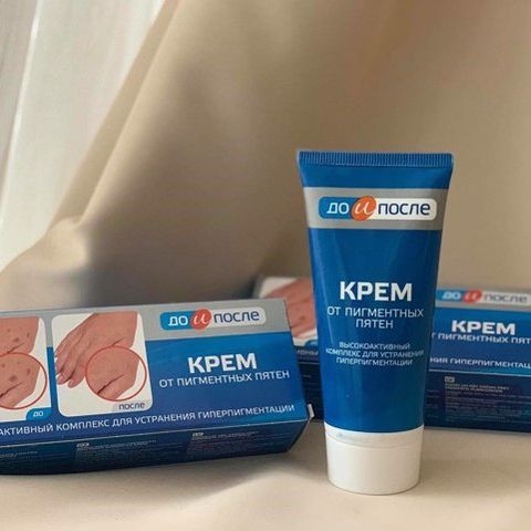 Kem Tay KPEM Trị Đồi Mồi, Vết Nám, Sạm, Đốm Nâu Da Tay