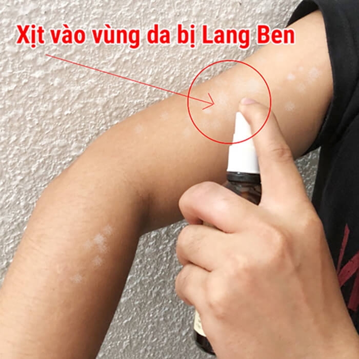 Nước Xịt Lang Ben Hồng Sơn 50ml