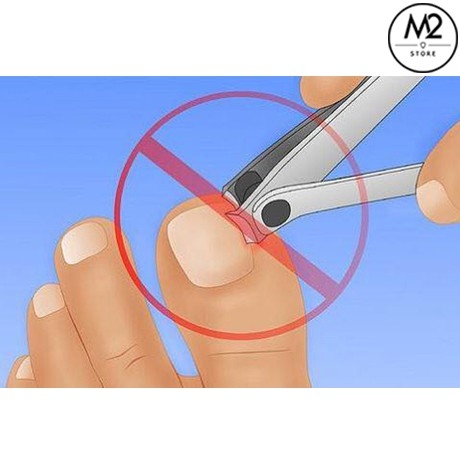 Miếng Dán Điều Chỉnh, Hỗ Trợ Móng Chân Mọc Ngược Tiện Dụng XIMO MD02