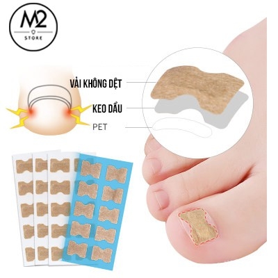 Miếng Dán Điều Chỉnh, Hỗ Trợ Móng Chân Mọc Ngược Tiện Dụng XIMO MD02