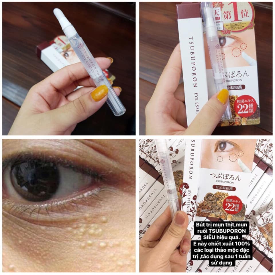 THUỐC TRỊ MỤN THỊT Ở MẮT GIẢM NỐT SẦN CẢI THIỆN THẨM MỸ KHUÔN MẶT