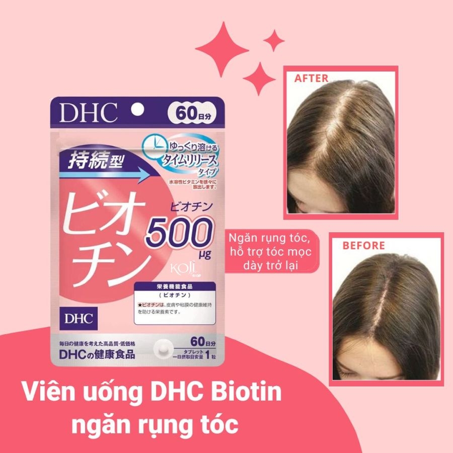 Viên uống ngăn ngừa rụng tóc biotin DHC - Gói 60 viên
