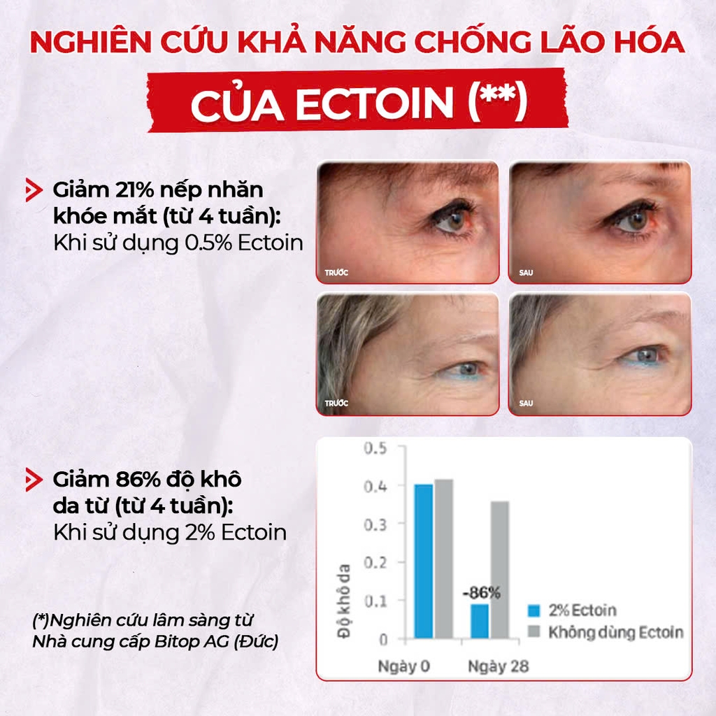 Serum Vitamin C Sắc Ngọc Khang 30ml - Tinh chất dưỡng trắng da diệu kỳ, mờ thâm nám, tàn nhang (tặng Sữa Dưỡng Thể 50g)