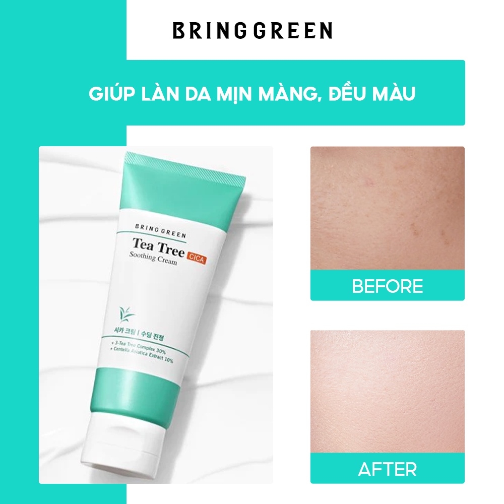 Kem dưỡng giảm mụn dịu da tràm trà Bring Green Tea Tree Cica Soothing Cream 100ml