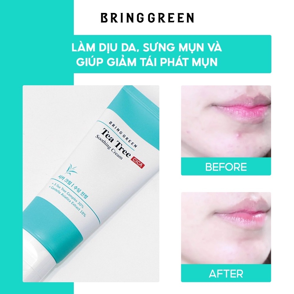 Kem dưỡng giảm mụn dịu da tràm trà Bring Green Tea Tree Cica Soothing Cream 100ml