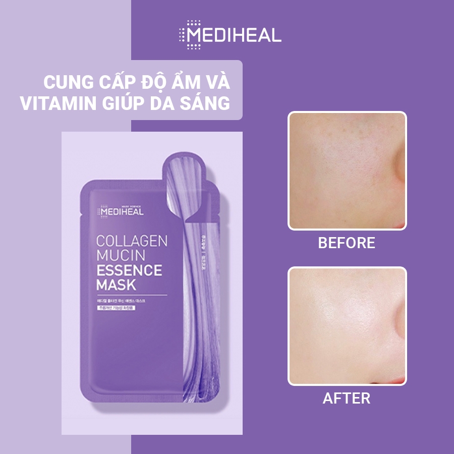 (Không vỏ) Mặt Nạ Giảm Nếp Nhăn Ngăn Ngừa Lão Hoá Mediheal Collagen Mucin Essence Mask 20ml