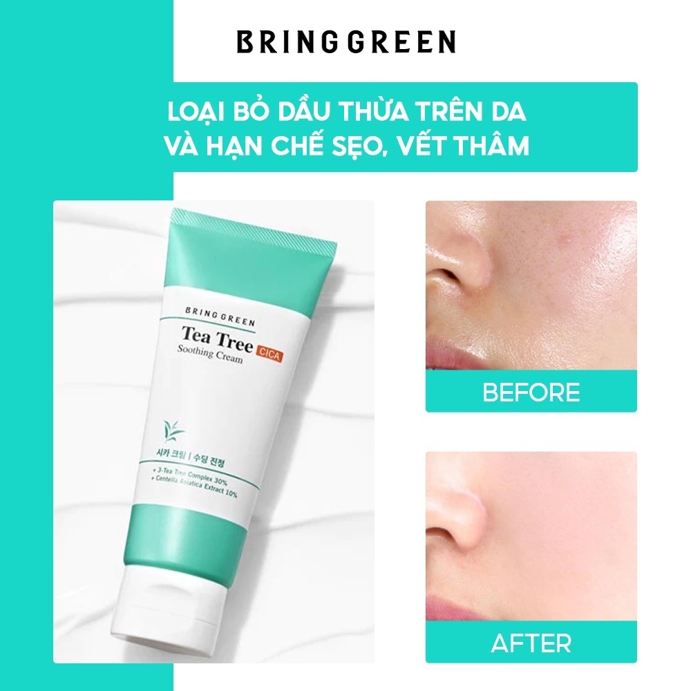 Kem dưỡng giảm mụn dịu da tràm trà Bring Green Tea Tree Cica Soothing Cream 100ml