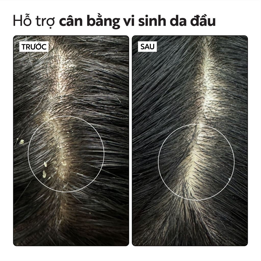 Nước dưỡng da đầu bồ kết Cocoon giảm gàu & chăm sóc da đầu nhạy cảm 140ml cocoon Viêt Nam chính hãng