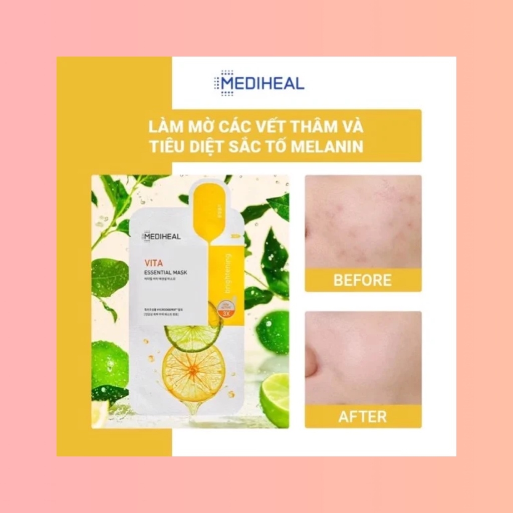 Mặt Nạ Giấy Mediheal Essential Mask Dưỡng Da Mềm Mịn Và Trắng Sáng - 24ml
