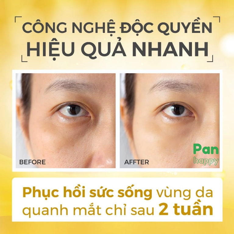 RECIPE Kem dưỡng da vùng mắt 30ML