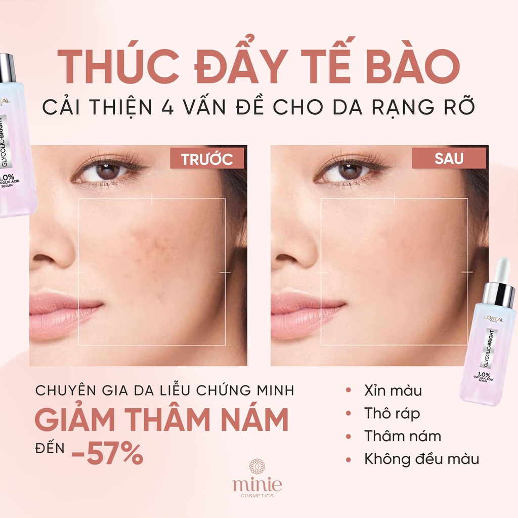 Serum L'oreal Tinh Chất Mờ Thâm Nám Sau 2 Tuần L'oreal Glycolic-Bright Instant Glowing Serum 30ml