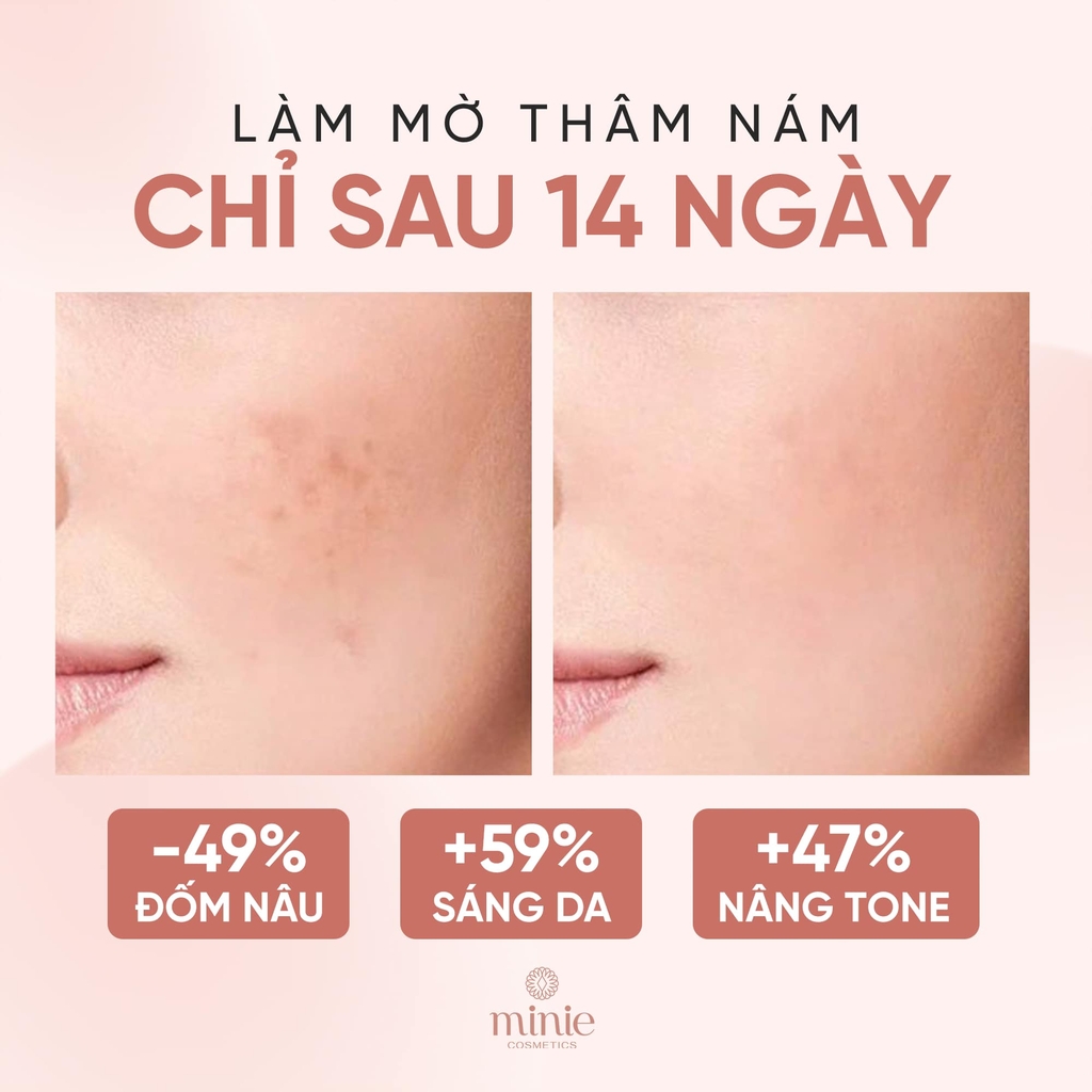 Kem Dưỡng Ban Ngày Hỗ Trợ Mờ Thâm Nám L'Oreal Glycolic Bright Glowing Cream Day