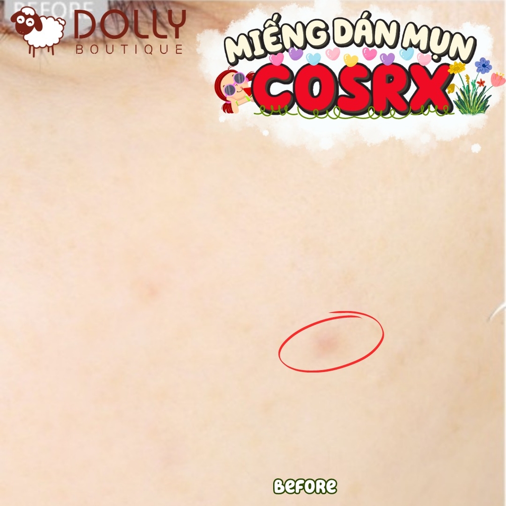 Miếng dán mụn Cosrx AC Collection Acne Patch 26 miếng / túi