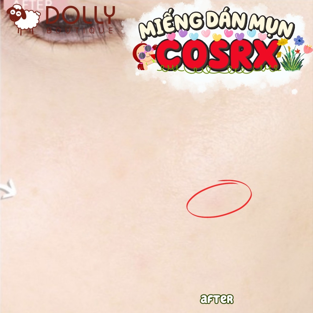 Miếng Dán Mụn COSRX Acne Pimple Master Patch 24 miếng/ gói