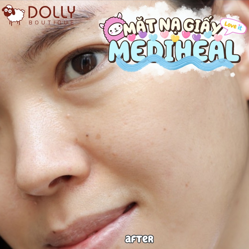 Mặt Nạ Giấy Làm Dịu Da Mediheal P.D.F AC - Dressing Ampoule Mask EX - 25ml