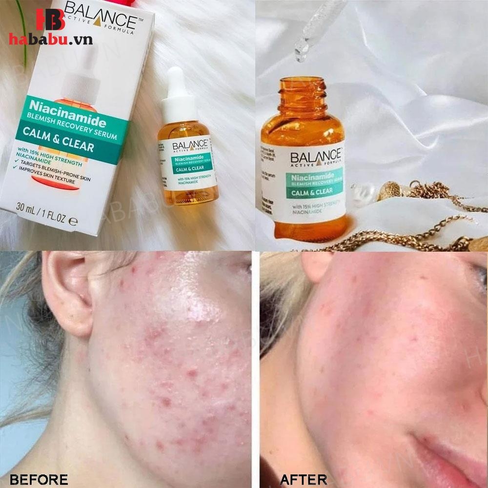 Serum Balance Active Formula Niacinamide 30ml chính hãng