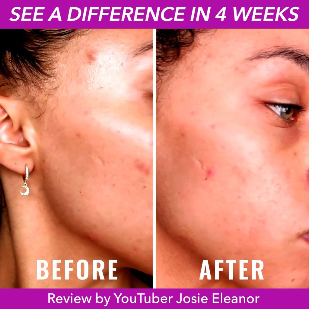 Tinh Chất làm đều màu da Good Molecules Discoloration Correcting Serum -