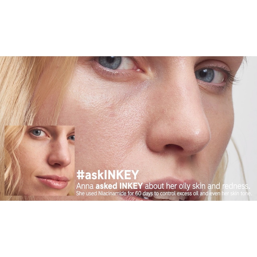 Serum dưỡng da làm mờ thâm mụn Niacinamide The INKEY List kiểm soát dầu