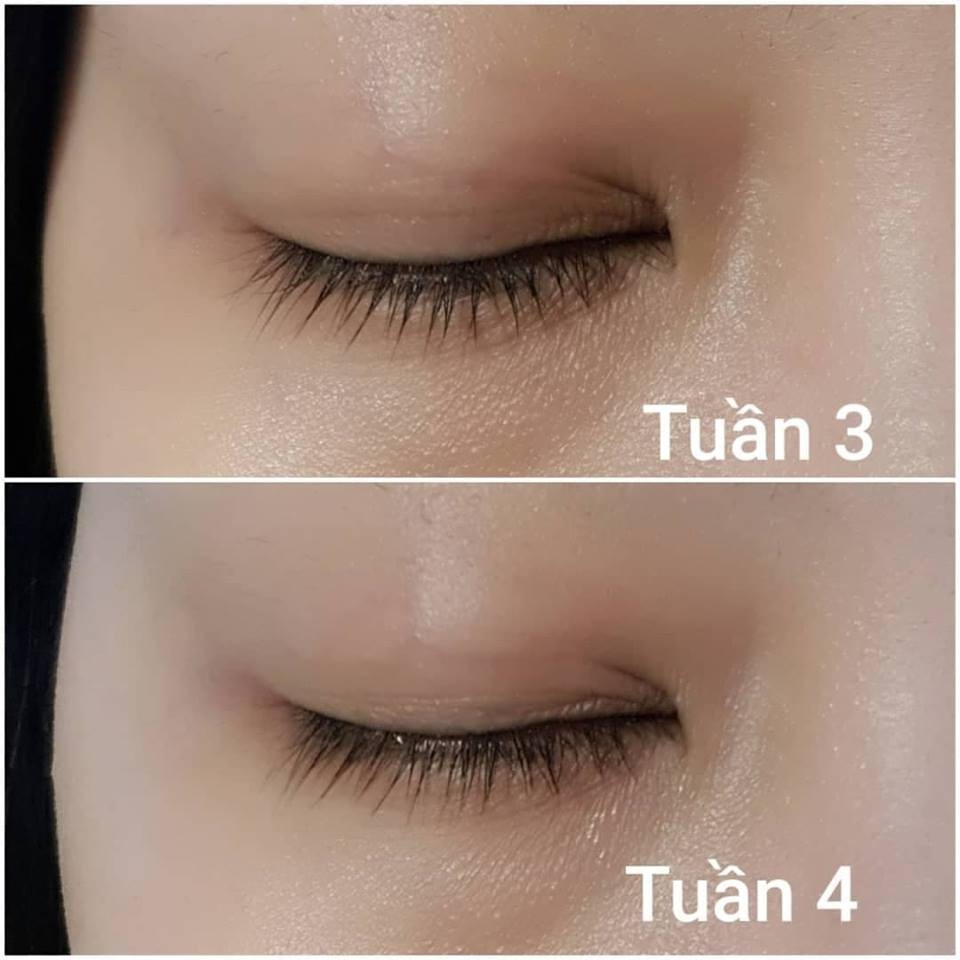 Serum kích mi mọc dài và dày EyEnvy tốt nhất tại Canada