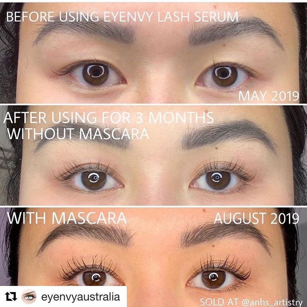 Serum kích mi mọc dài và dày EyEnvy tốt nhất tại Canada