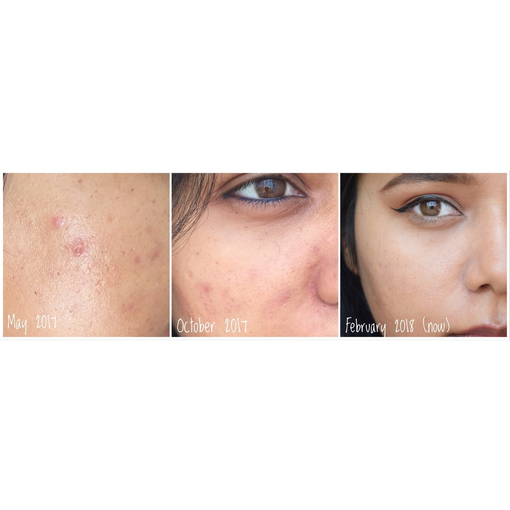 Serum The Ordinary Buffet tinh chất chống lão hoá cấp nước da