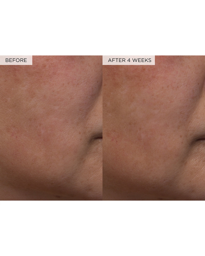 Nước Hoa Hồng Giúp Giảm Lỗ Chân Lông Glow Recipe Watermelon Glow PHA + BHA Pore-Tight Toner 150ML