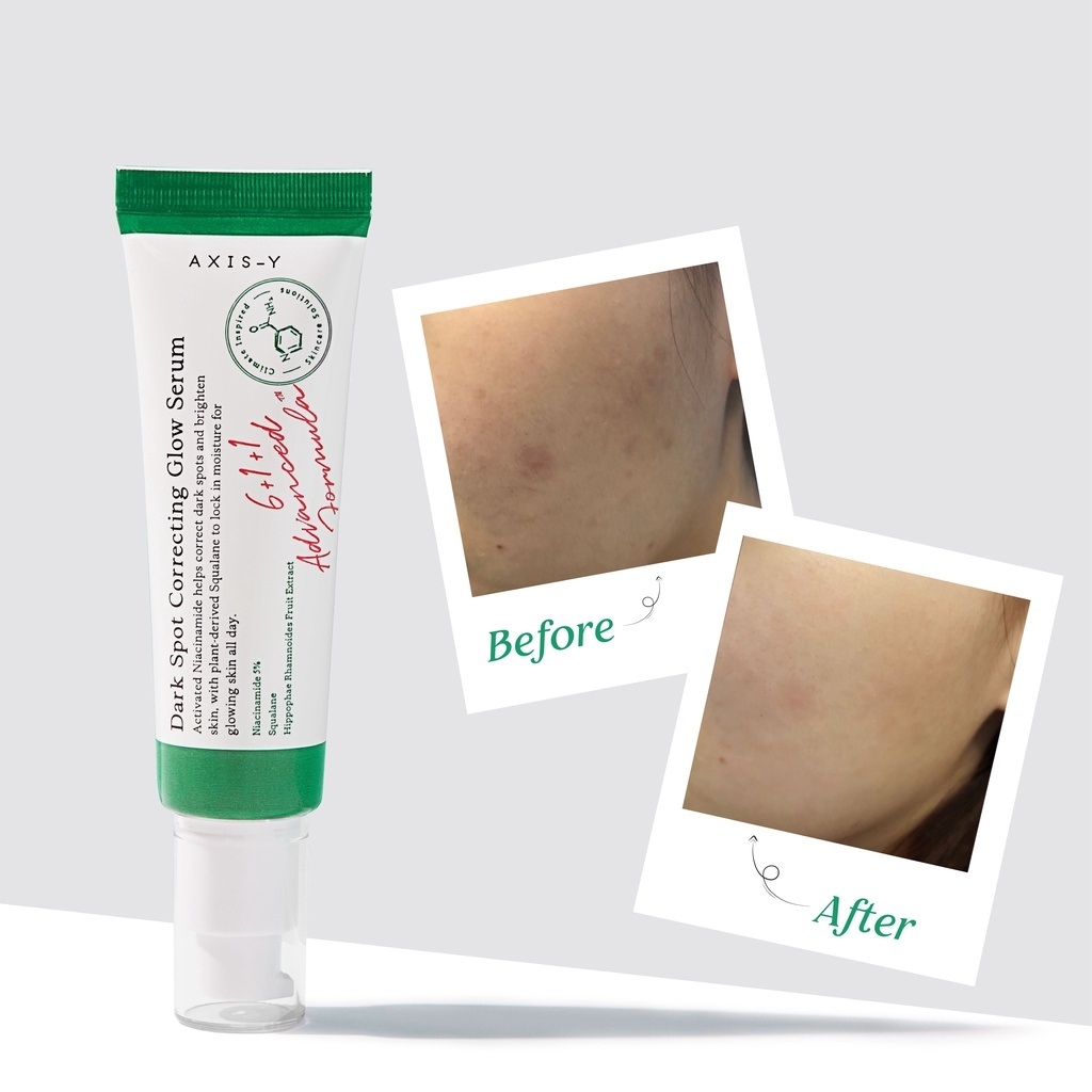 Tinh Chất Dưỡng Căng Bóng Mờ Thâm Axis-Y Dark Spot Correcting Glow Serum 50 ML