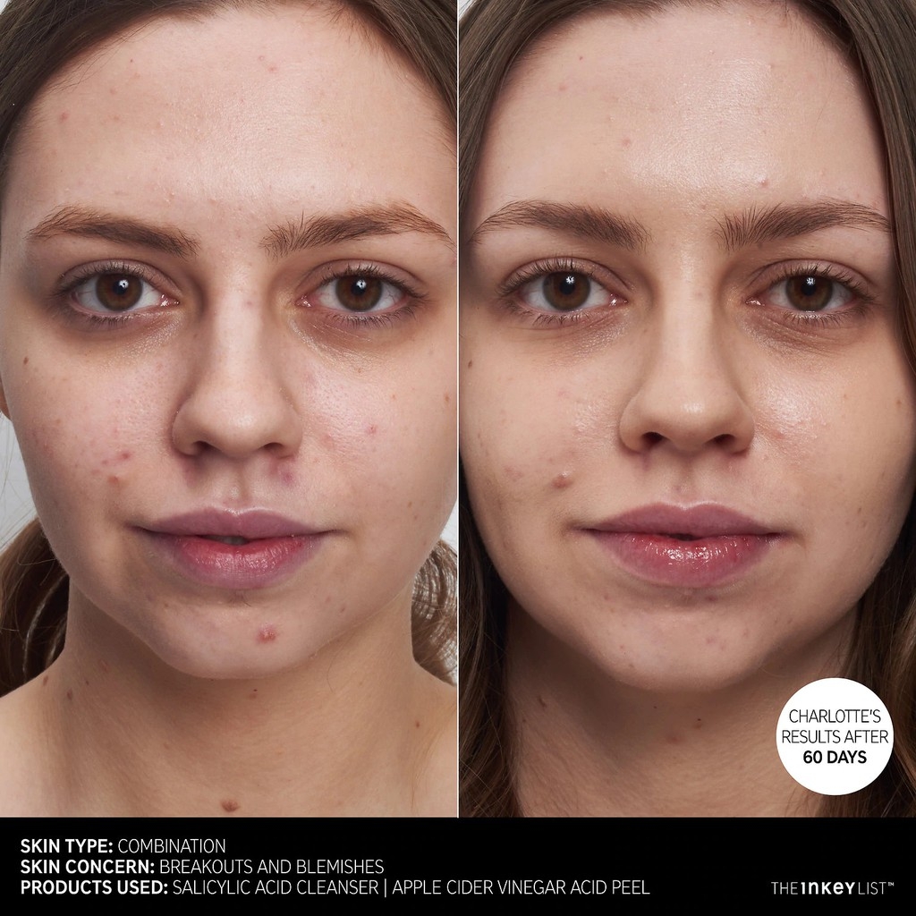 SRM giảm mụn The Inkey List Salicylic Acid Cleanser dành cho da dầu