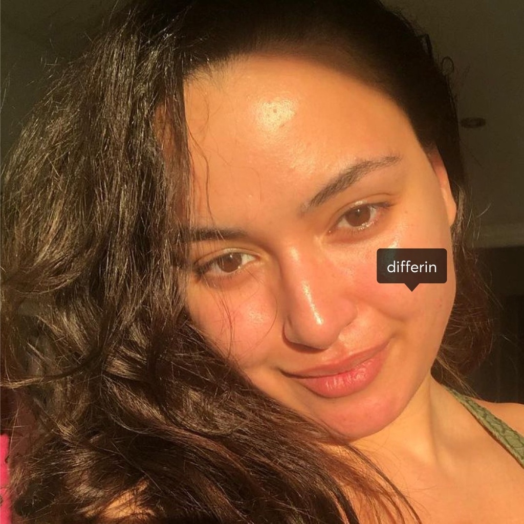 Gel giảm mụn Differin Adapalene 0.1%