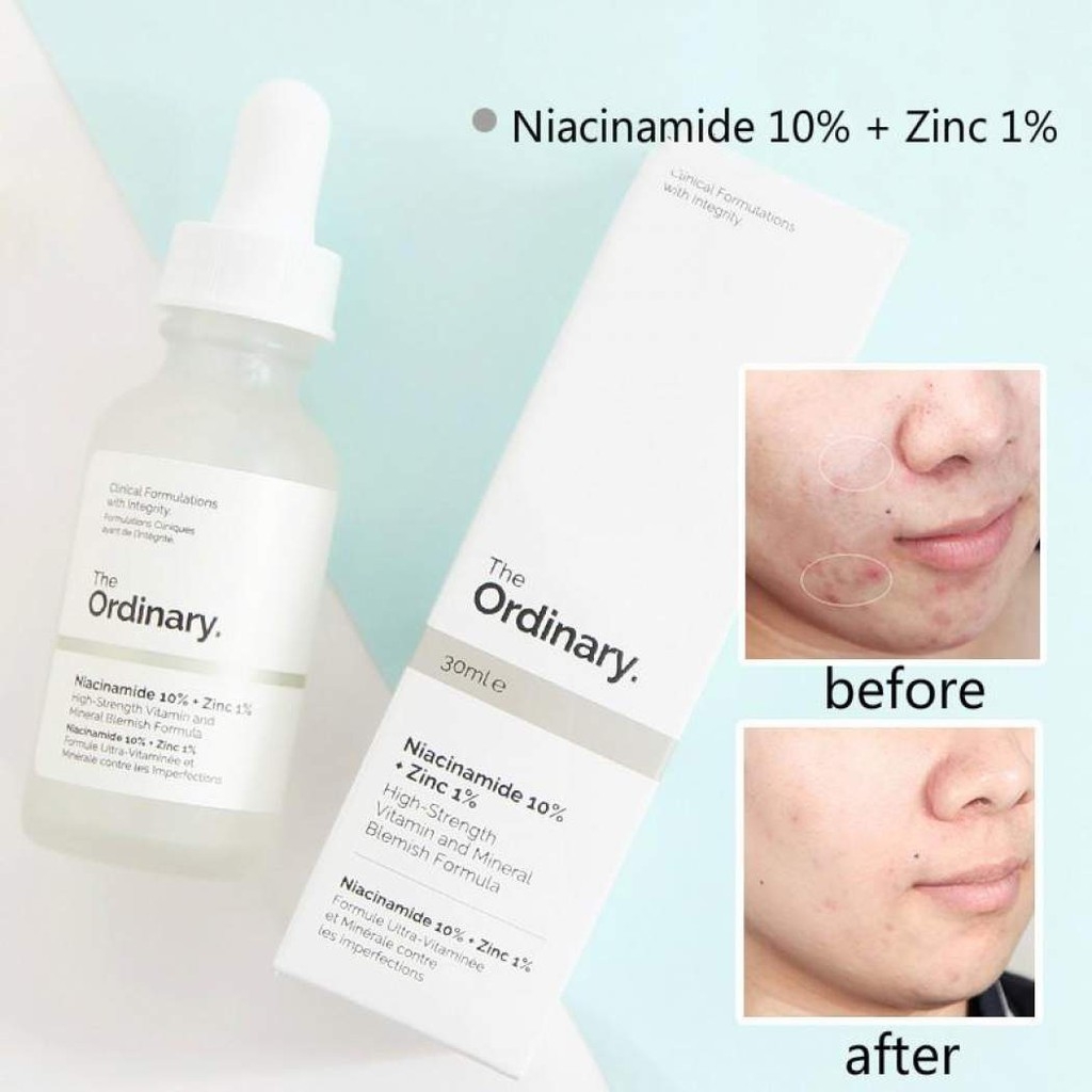 Serum dưỡng da làm mờ thâm mụn The Ordinary Niacinamide 10% + Zinc 1%