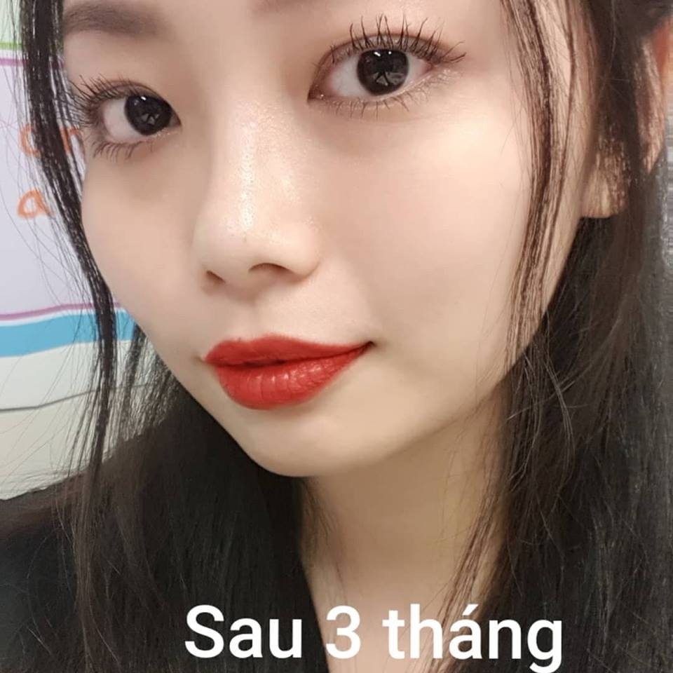 Serum kích mi mọc dài và dày EyEnvy tốt nhất tại Canada