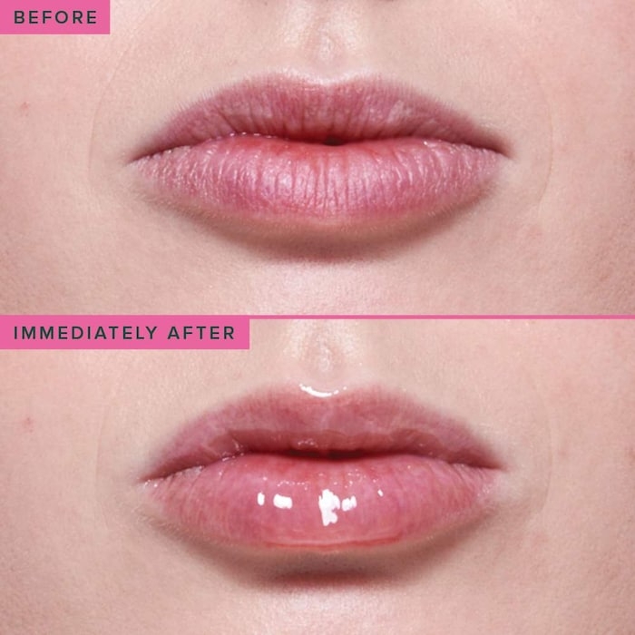 Set dưỡng làm căng và sáng môi Farmacy Lip Duo