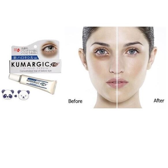 Kem trị thâm quầng mắt Kumargic Eye  Cream  20g