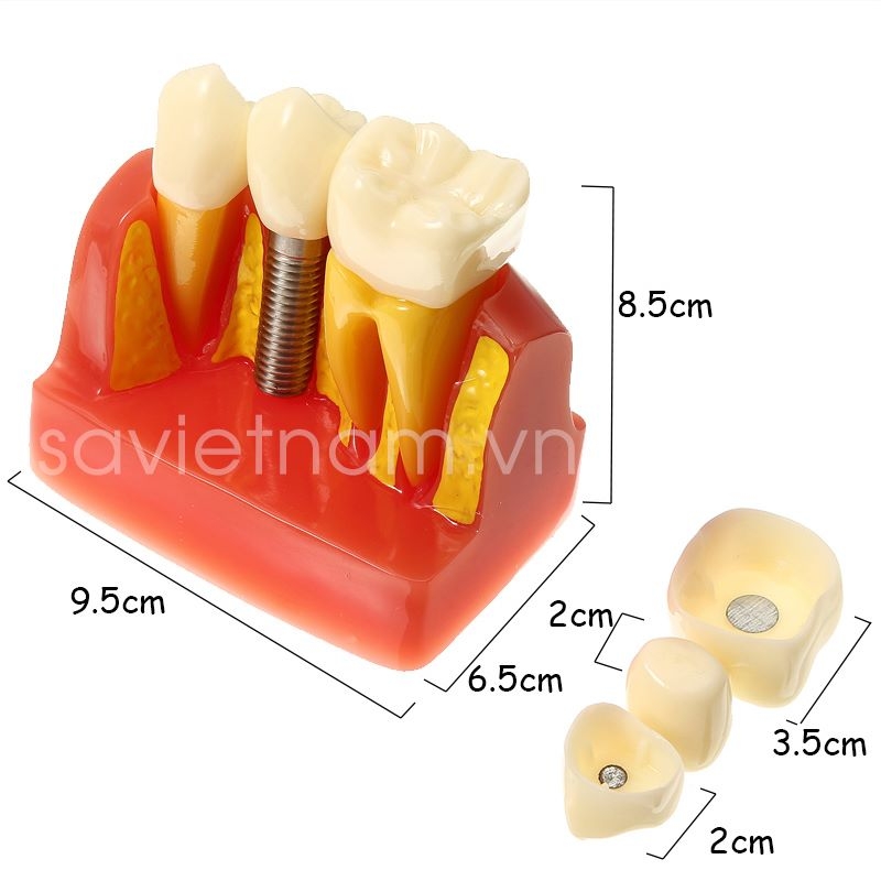 Mô hình giải phẫu khoang miệng người mô hình hàm răng nha khoa VIETVALUE
