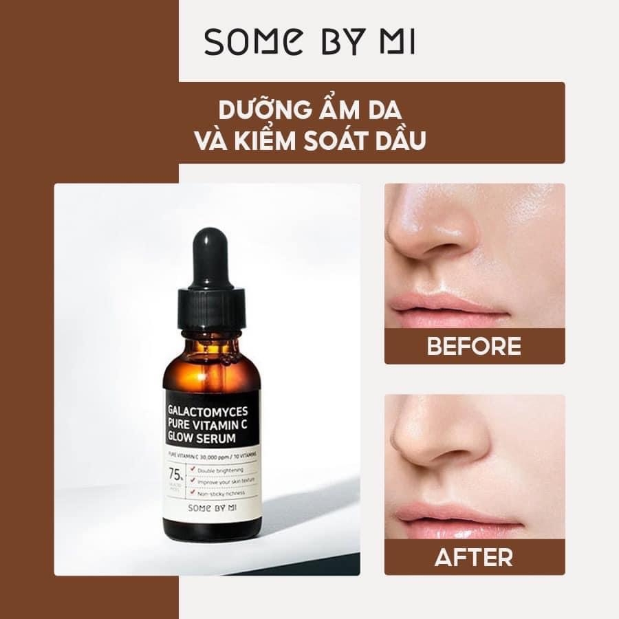 Tinh Chất Dưỡng Trắng Chống Lão Hoá Some By Mi Galactomyces Pure Vitamin C Glow Serum 30ml